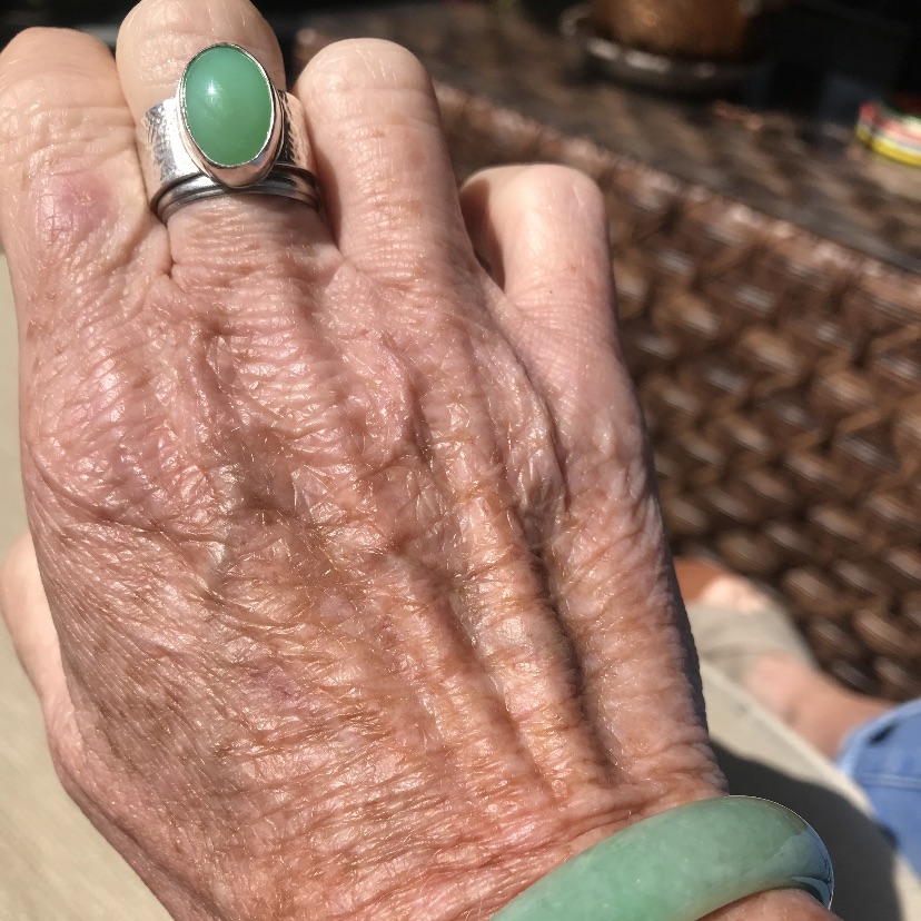 IMG_4156 ChrysopraseRing